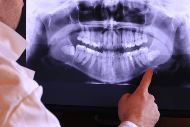 Best Emergency Treatment for Dental Infections or Abscesses in Giddings, TX
