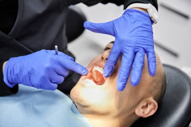 Best Emergency Root Canal Treatment in Giddings, TX