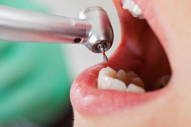 Best Urgent Care for Lost Fillings or Crowns in Giddings, TX